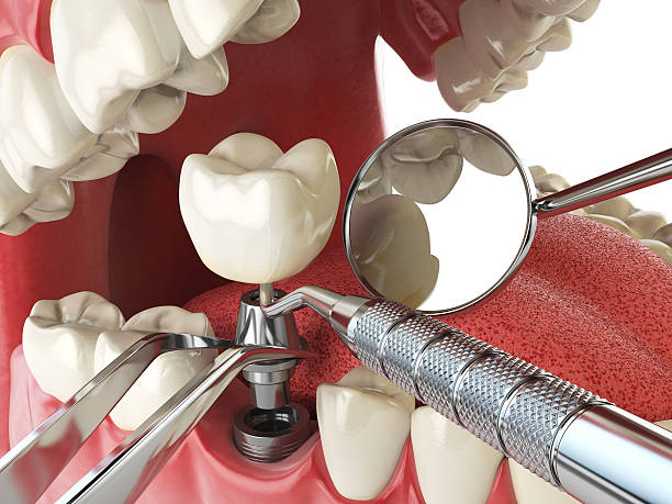 Best Emergency Dental Surgery in Kerrville, TX